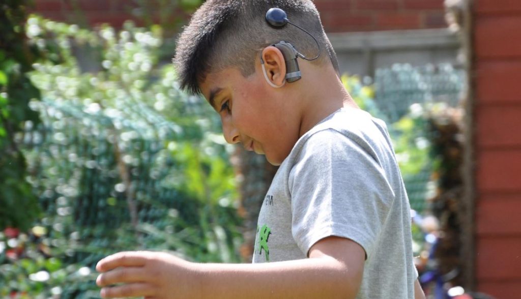 cochlear implant cost in Pakistan