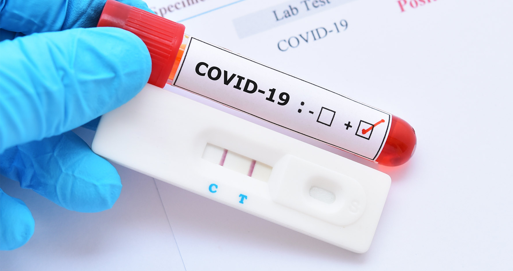 PCR Test